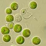 کلرلا ولگاریس (Chlorella vulgaris)