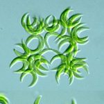 سلناستروم (Selenastrum sp.)